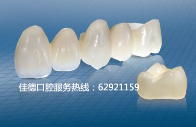全瓷牙烤瓷冠修复材料介绍