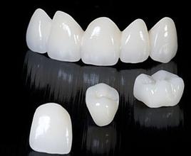使用烤瓷牙应该注意什么?