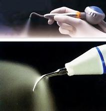 牙结石清理的方法有哪些？
