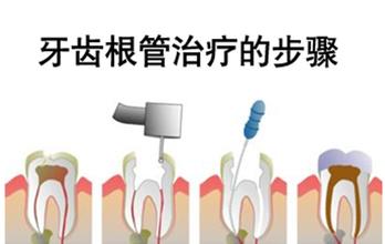 根管的治疗后牙疼怎么办？
