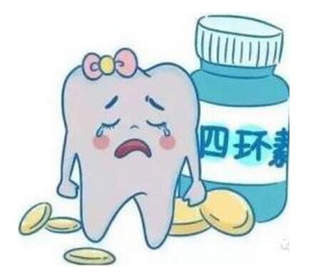 四环素沉着牙怎么办