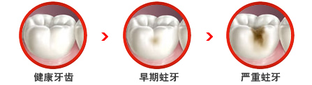 龋坏